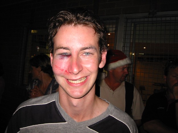 Damo's injuries.